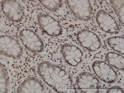 Immunohistochemistry-Paraffin: GMEB1 Antibody (2A8) [H00010691-M01]