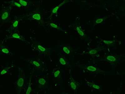 Immunocytochemistry/ Immunofluorescence: GMEB1 Antibody [NBP2-99588]