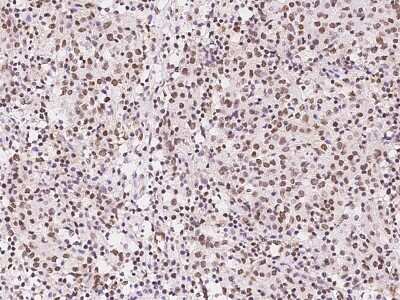 Immunohistochemistry-Paraffin: GMEB1 Antibody [NBP2-99588]
