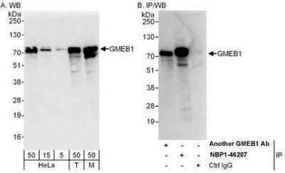 Western Blot: GMEB1 Antibody [NBP1-46207]