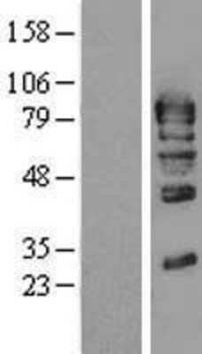 Western Blot: GMEB1 Overexpression Lysate [NBL1-11138]