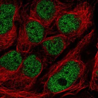 Immunocytochemistry/ Immunofluorescence: GMEB2 Antibody [NBP2-56893]