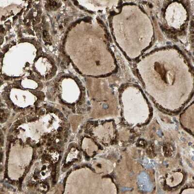 Immunohistochemistry-Paraffin: GMEB2 Antibody [NBP1-81421]
