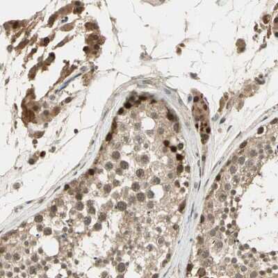 Immunohistochemistry-Paraffin: GMEB2 Antibody [NBP1-81421]