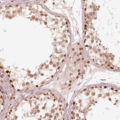 Immunohistochemistry-Paraffin: GMEB2 Antibody [NBP2-56893]