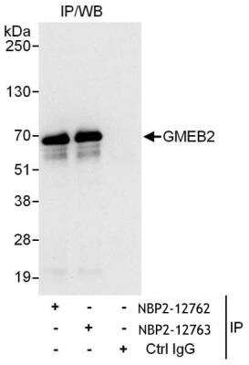 Immunoprecipitation: GMEB2 Antibody [NBP2-12762]