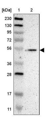 Western Blot: GMEB2 Antibody [NBP1-81421]