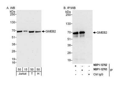 Western Blot: GMEB2 Antibody [NBP2-12763]