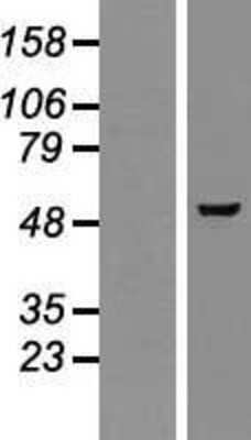 Western Blot: GMEB2 Overexpression Lysate [NBP2-07457]