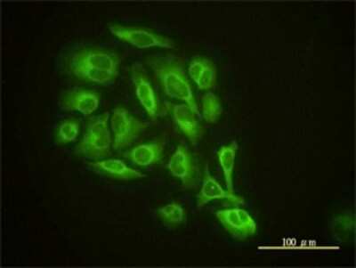 Immunocytochemistry/ Immunofluorescence: GMF-beta Antibody (2G12-2A2) [H00002764-M01]