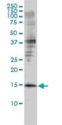 Western Blot: GMF-beta Antibody (2G12-2A2) [H00002764-M01]