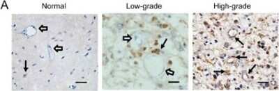Immunohistochemistry: GMF-beta Antibody [NBP1-89755]