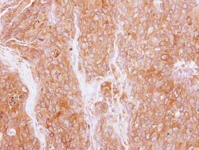 Immunohistochemistry-Paraffin: GMF-beta Antibody [NBP2-43647]