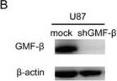 Knockdown Validated: GMF-beta Antibody [NBP1-89755]