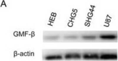 Western Blot: GMF-beta Antibody [NBP1-89755]