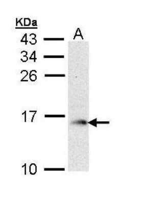 Western Blot: GMF-beta Antibody [NBP2-43647]