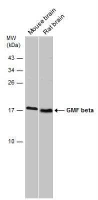 Western Blot: GMF-beta Antibody [NBP2-43647]