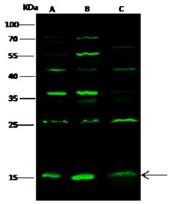 Western Blot: GMF-beta Antibody [NBP2-98937]