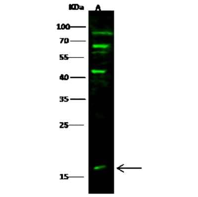 Western Blot: GMF-beta Antibody [NBP3-00104]