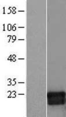 Western Blot: GMF-beta Overexpression Lysate [NBL1-11139]