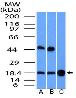 Western Blot: GMFG Antibody [NBP2-31367]