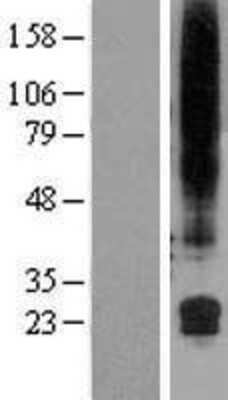 Western Blot: GML Overexpression Lysate [NBL1-11142]