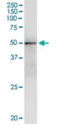 Immunoprecipitation: GMPPA Antibody (2F1) [H00029926-M01]