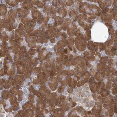 Immunohistochemistry-Paraffin: GMPPA Antibody [NBP2-38255]