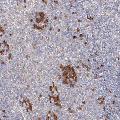Immunohistochemistry-Paraffin: GMPPA Antibody [NBP1-85904]