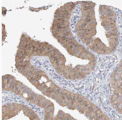 Immunohistochemistry-Paraffin: GMPPA Antibody [NBP1-85904]