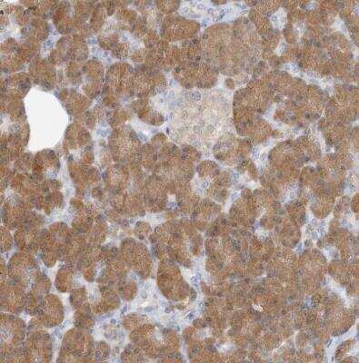 Immunohistochemistry-Paraffin: GMPPA Antibody [NBP1-85904]