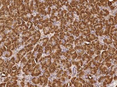 Immunohistochemistry-Paraffin: GMPPA Antibody [NBP2-97140]