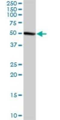 Western Blot: GMPPA Antibody [H00029926-D01P]