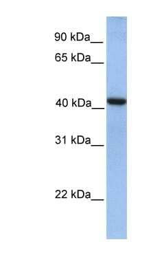 Western Blot: GMPPA Antibody [NBP1-55233]