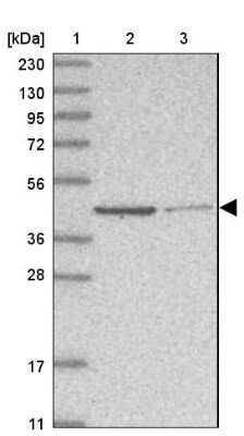 Western Blot: GMPPA Antibody [NBP1-85904]