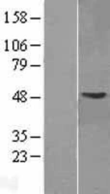 Western Blot: GMPPA Overexpression Lysate [NBL1-11144]