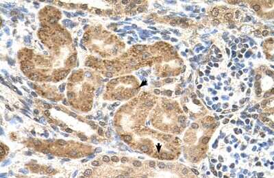 Immunohistochemistry-Paraffin: GMPPB Antibody [NBP1-55168]