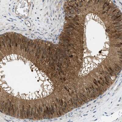 Immunohistochemistry-Paraffin: GMPPB Antibody [NBP1-81366]