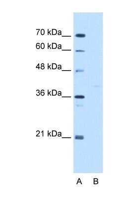 Western Blot: GMPPB Antibody [NBP1-55168]