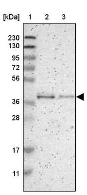 Western Blot: GMPPB Antibody [NBP1-81366]