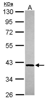 Western Blot: GMPPB Antibody [NBP2-16695]