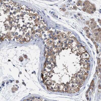 Immunohistochemistry-Paraffin: GMPR1 Antibody [NBP1-87459]