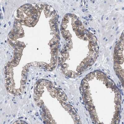 Immunohistochemistry-Paraffin: GMPR1 Antibody [NBP1-87459]