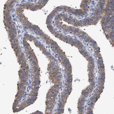 Immunohistochemistry-Paraffin: GMPR1 Antibody [NBP1-87459]