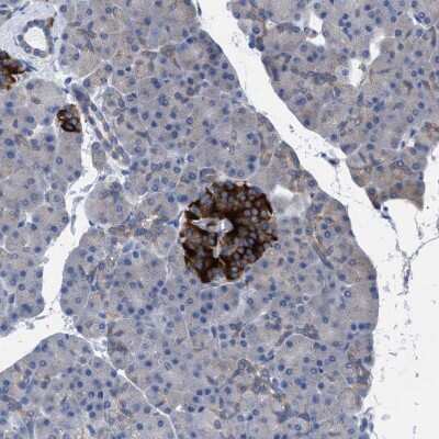 Immunohistochemistry-Paraffin: GMPR1 Antibody [NBP1-87459]