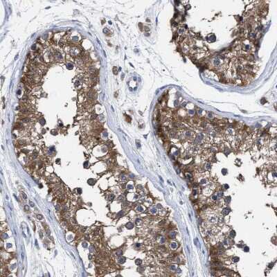 Immunohistochemistry-Paraffin: GMPR1 Antibody [NBP1-87459]
