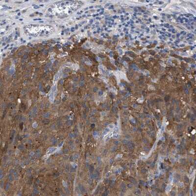 Immunohistochemistry-Paraffin: GMPR1 Antibody [NBP1-87459]