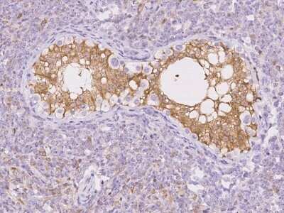 Immunohistochemistry-Paraffin: GMPR1 Antibody [NBP2-97216]