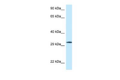 Western Blot: GMPR1 Antibody [NBP2-87513]