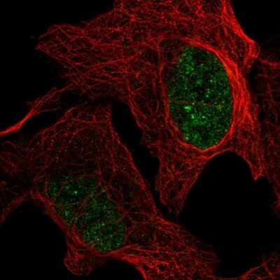 Immunocytochemistry/ Immunofluorescence: GMPR2 Antibody [NBP2-57445]